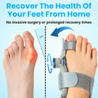Bunion™ Fix
