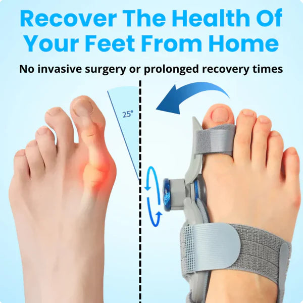Bunion™ Fix