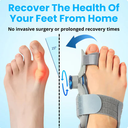 Bunion™ Fix